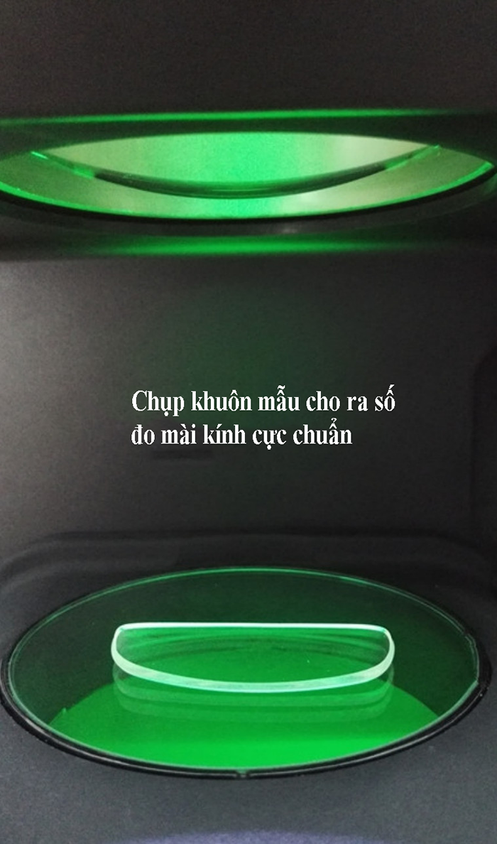 Hình ảnh Chụp khuôn mẫu